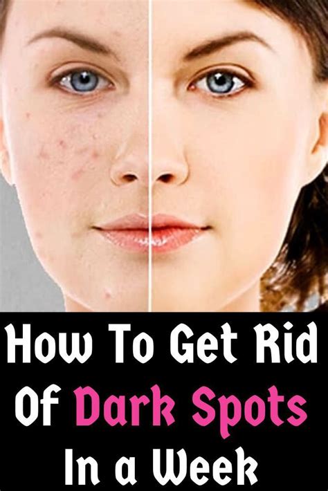 how to get rid of dark spots after shaving